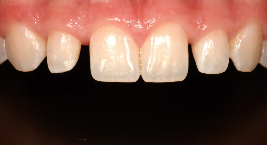 Comprehensive Orthodontic